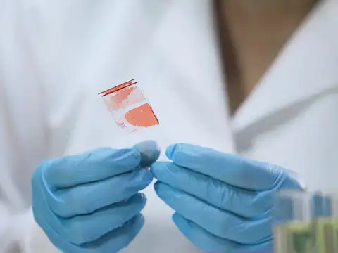 How To Know If You Have Thalassaemia