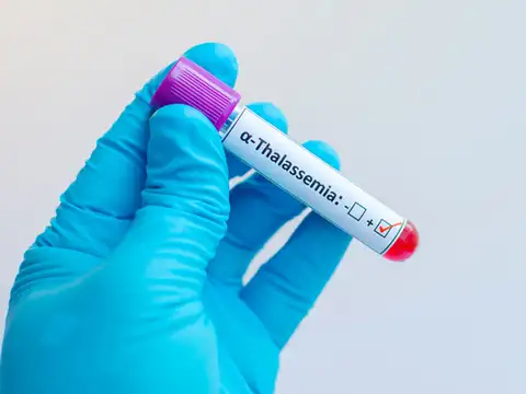 Preventing Thalassemia