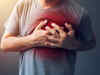 Hydroxychloroquine can cause 'serious' heartbeat disturbances