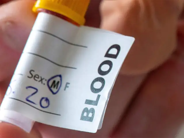 Aggravating Factors Does Blood Type Determine Covid Risk Aggravating Factors Does Blood Type Determine Covid Risk The Economic Times