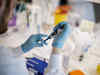 ICMR invites cos to develop its anti-serum against Covid