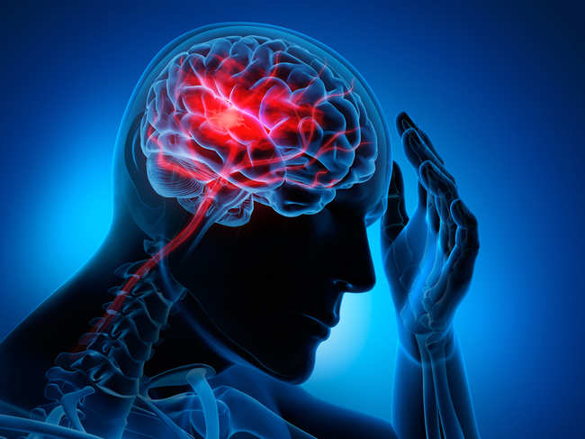 The scientists said the most common brain complication observed was stroke, which was reported in 77 of 125 patients.