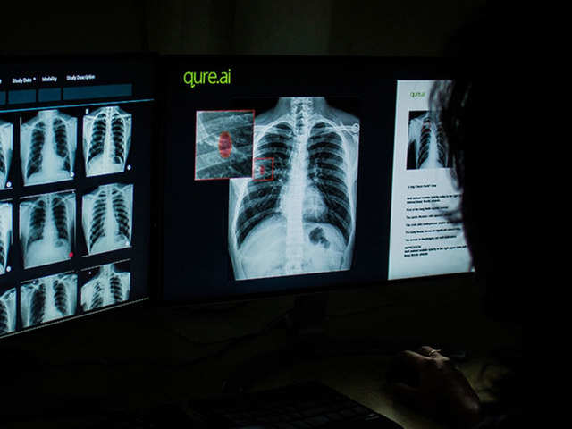 This AI checks for lung problems and more
