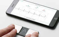 AliveCor enters India with personal ECG device