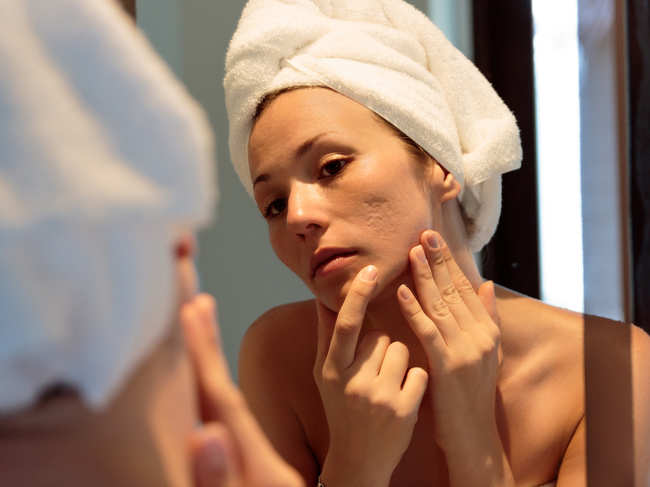The researchers believe the findings may help PPE wearers seek the best skin-saving products.