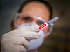 EU says could approve Pfizer and Moderna coronavirus vaccines this year