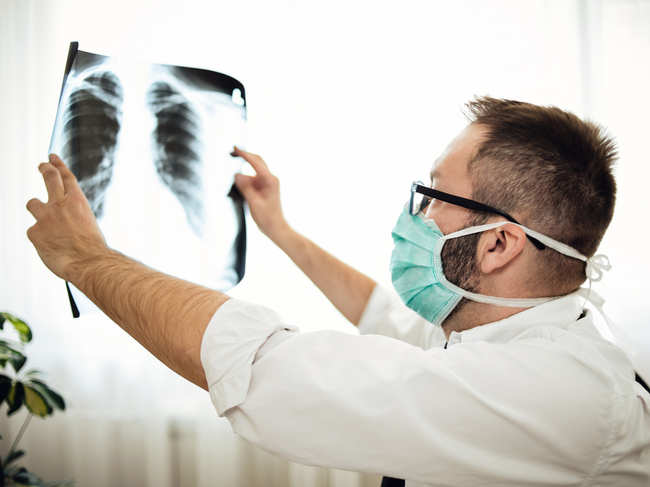 lungs-xray_iStock