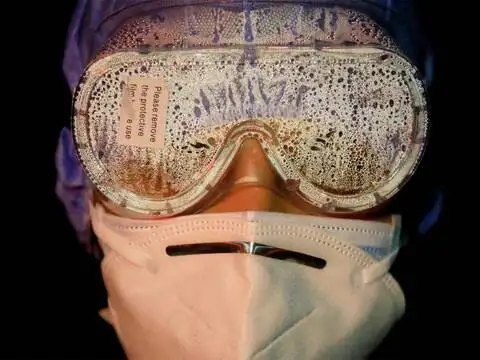 Goggles covered with vapor