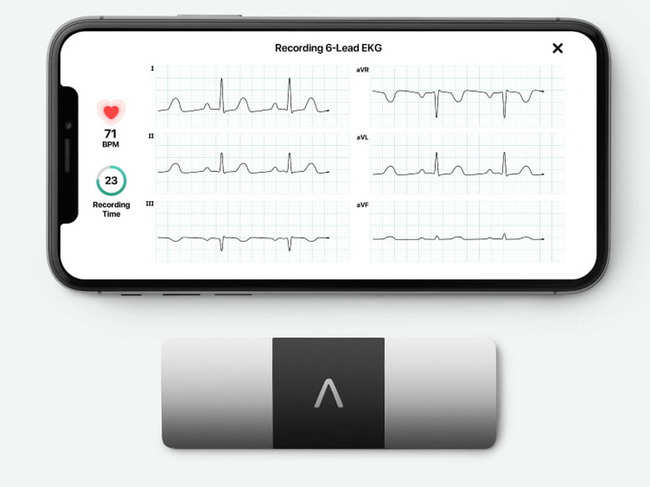 The device offers a six-lead ECG report. Along with two electrodes on the top, there is one additional electrode on the bottom.