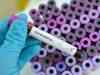 ‘Out of control’ virus strain in UK, govt calls meet
