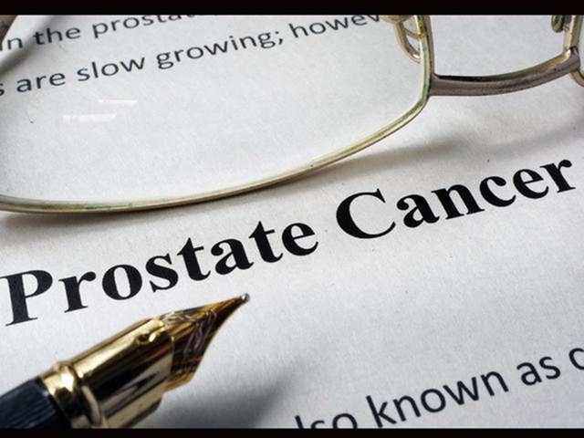 Myth: Every Man Should Be Screened For Prostate Cancer