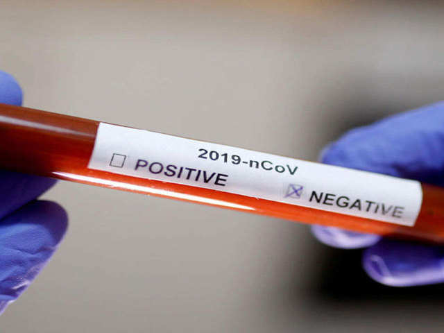 Negative coronavirus report