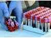 Visakhapatnam: 59 Andhra University students test positive for coronavirus