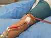 Why plasma therapy? Seeking details cut down requests for blood at RIMS