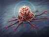 'Can treat tumors that you cannot see'. Radiation drugs hunt & kill cancer cells, says new study