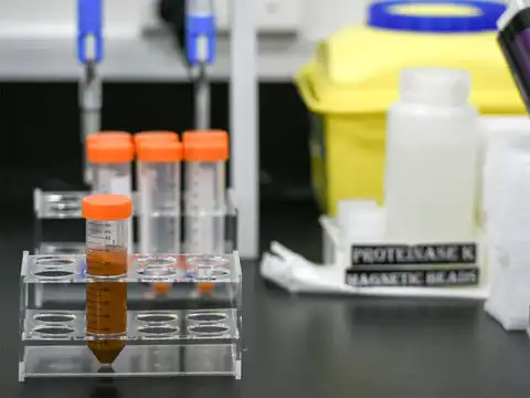 Spike-shaped proteins