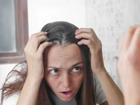 Fungal Infection Of Scalp