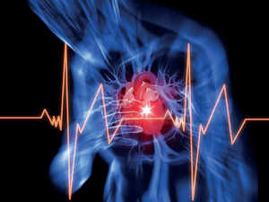 Difference between a heart attack and cardiac arrest
