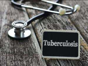 tuberculosis TB