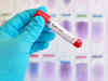 Molbio Diagnostics gets DCGI nod for Nipah virus testing
