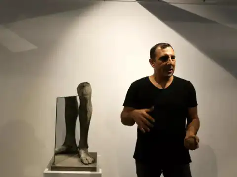 1,600 amputees