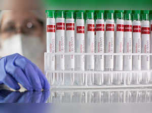 FILE PHOTO: FILE PHOTO: Test tubes labelled "COVID-19 Test positive" are seen in this illustration picture