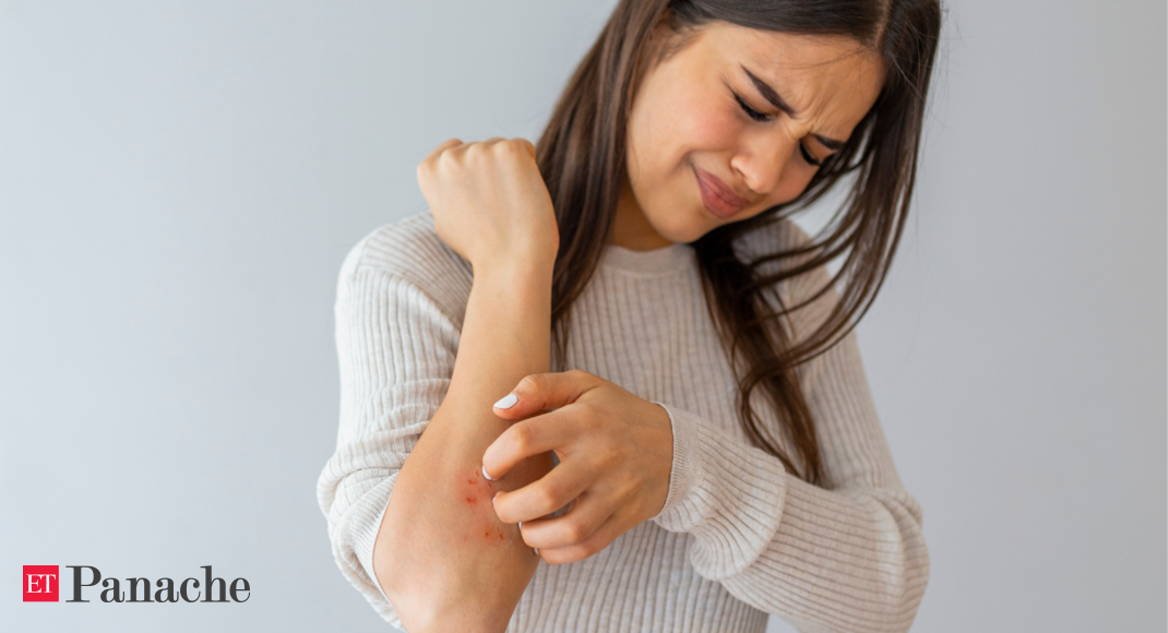 Eczema to hives: how to combat Covid skin rashes thumbnail