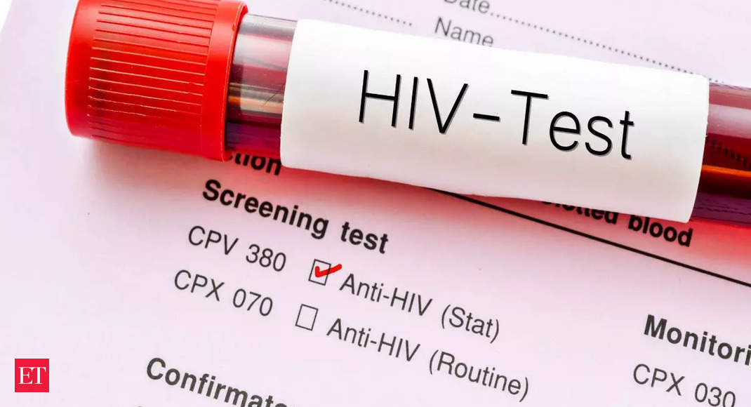 Over 17 lakh contracted HIV in last 10 yrs: RTI reply