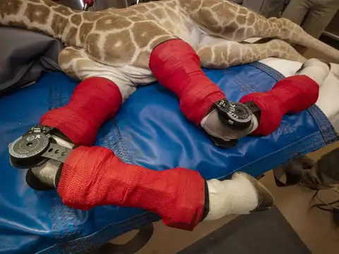 ​Hyperextended joint bones