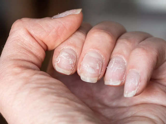 ​COVID nails