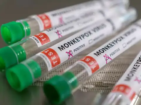 ​Precautions to take