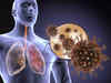 Risk of blood clots in lung doubled for Covid survivors: US study