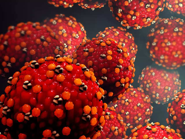 ​Virus which causes chickenpox