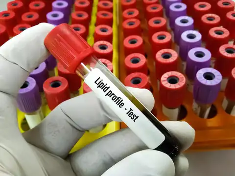 ​Lipid profile