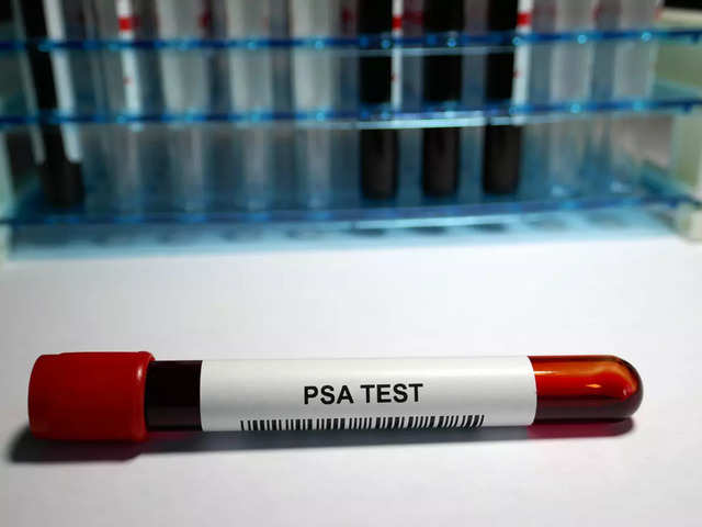 ​Prostate-Specific Antigen (PSA) Test