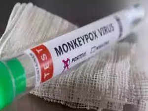 Suspected monkeypox case found in Kerala, samples sent for testing