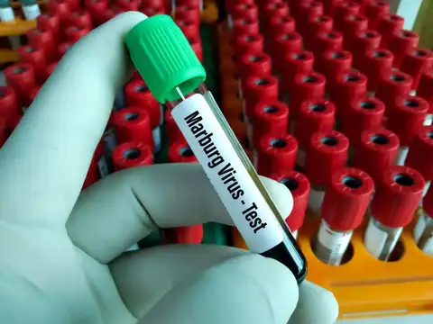 ​Second outbreak in West Africa