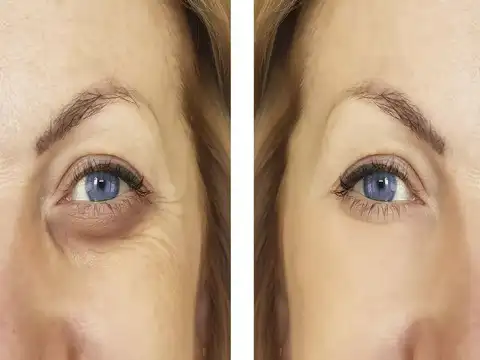 ​Nonsurgical options