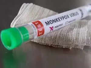Delhi: Suspected monkeypox patient tests negative, discharged from hospital