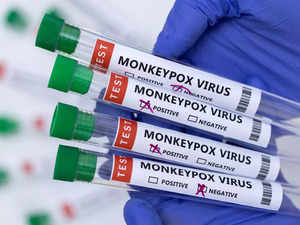 monkeypox-virus--R