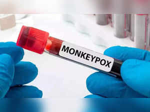 Kerala confirms that deceased youth tested positive for monkeypox in UAE