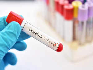 ​What is COVID-19