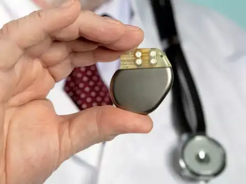 ​Pacemaker