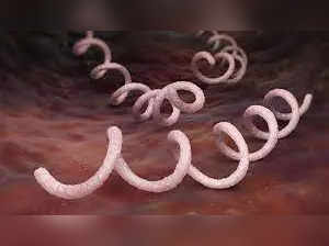 Why is Syphilis surging in US? All you need to know about the disease