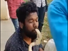 Video: Man tries to kiss snake, gets bitten on lip
