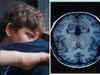 New study claims Covid-19 lockdown increased ‘brain-age’ of many teenagers, stress may have been an additional trigger