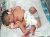 Woman gives birth to a miracle baby girl with 4 legs in Gwalior, Madhya Pradesh. Read more