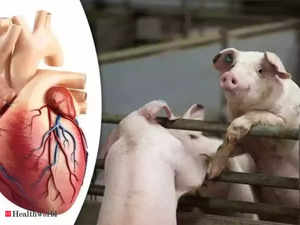 Making pig livers humanlike in quest to ease organ shortage