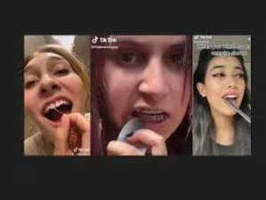 TikTok trends show how to remove braces with spoon, dentists label it as danger to teeth