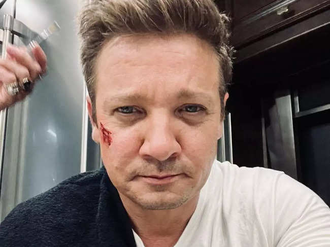 Reports said that Jeremy Renner's injuries were 'extensive'.